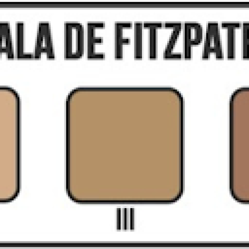 O QUE É FOTOTIPO E QUAL É O SEU?