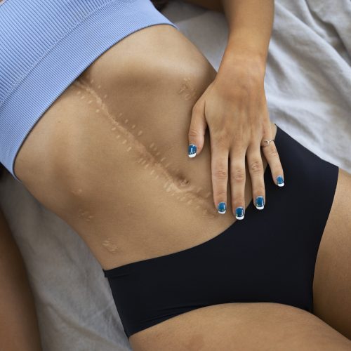 Benefícios da Drenagem Linfática no Pós-operatório